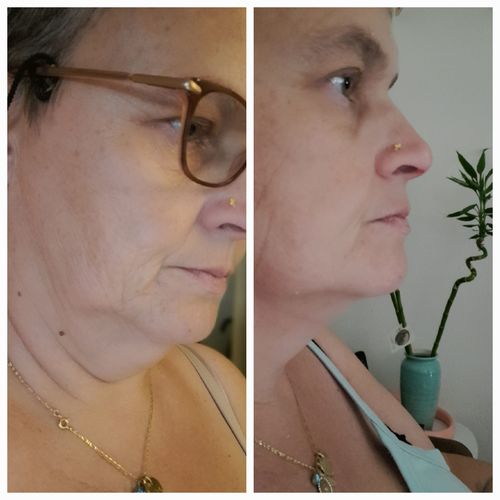Customer photo review of Masque Visage Fontanay™ Lift Raffermissant