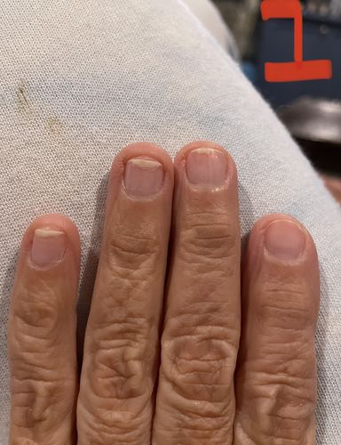 Customer photo review of Rocket Nail Fuel Nail Repair - Clear