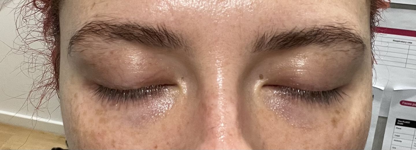 Customer photo review of Purely Lashes Lash Growth Serum