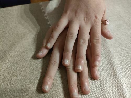 Customer photo review of Bague d'Anxiété Ajustable - SAKURA