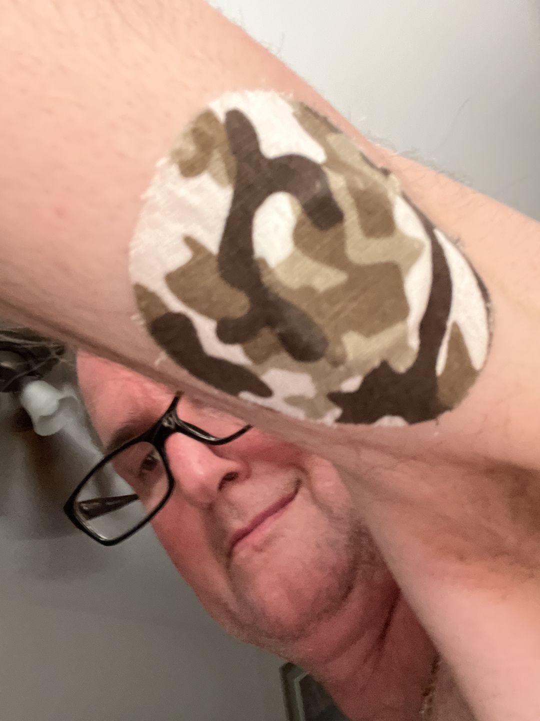 Customer photo review of Skin Grip Original - Freestyle Libre Adhesive Patches