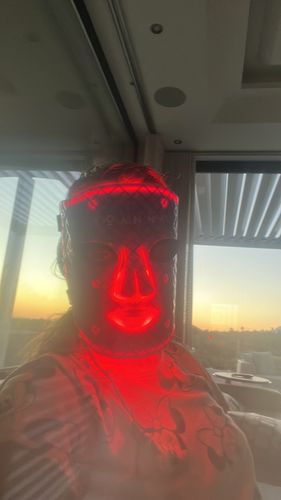 Customer photo review of LED Light Therapy Mask