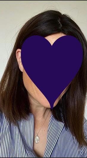 Customer photo review of Virgin Human Hair Mono Hair Topper for Full Volume Darkest Brown #2