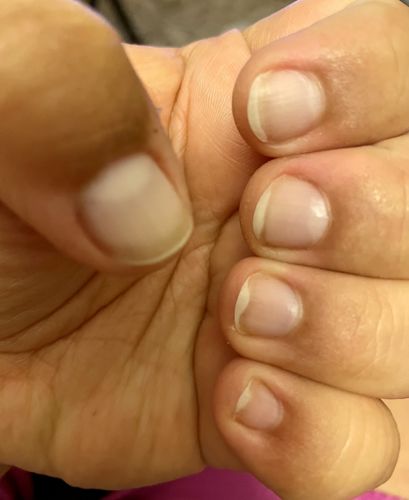 Customer photo review of Rocket Nail Fuel Nail Repair - Clear