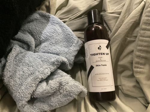 Customer photo review of TIGHTEN UP bump & ingrown hair tonic