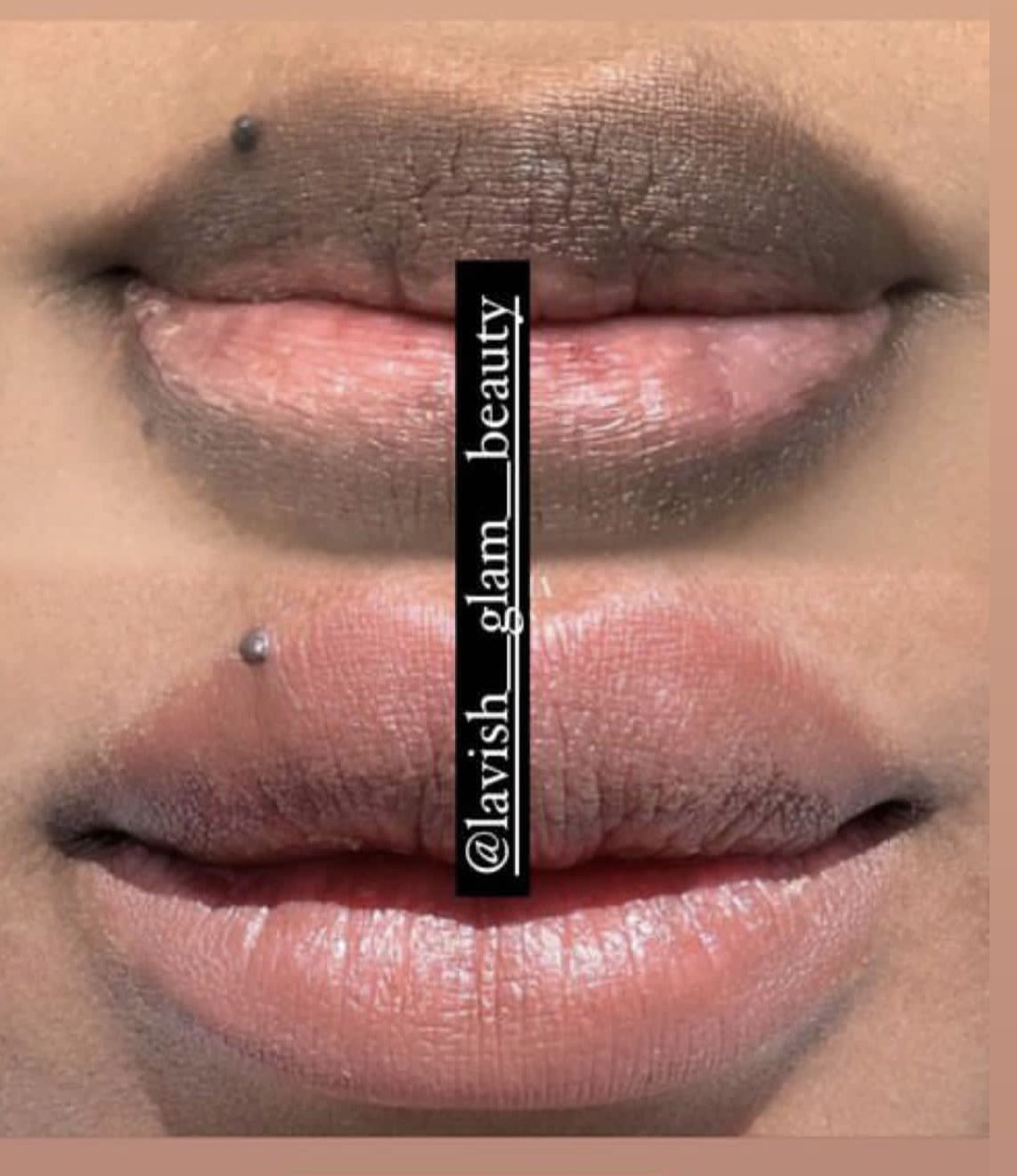 Customer photo review of Pink Lip Kit