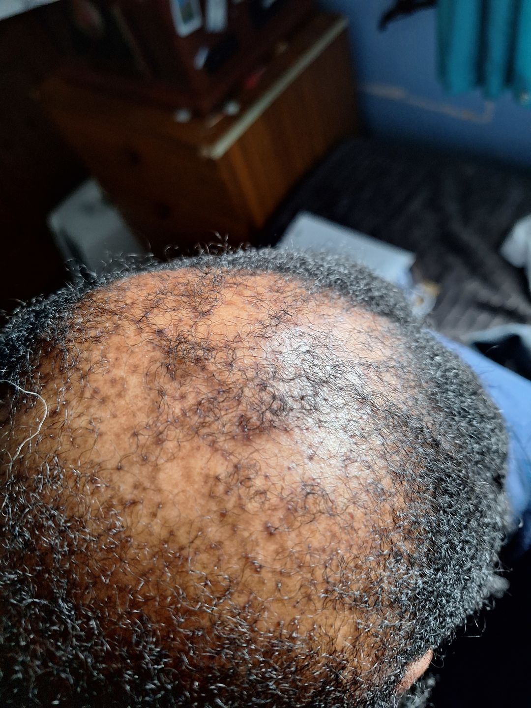 Customer photo review of Hair Growth Potion - Extra Strength