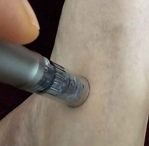 Customer photo review of 16 Pin Replacement Cartridges for M8 PowerDerm 10X