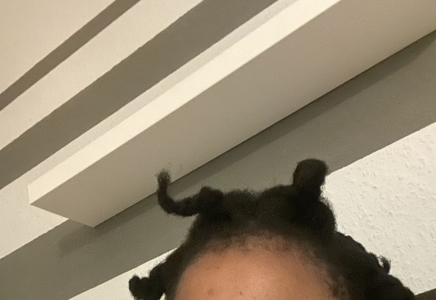 Customer photo review of TRÈS[S] GROWN - Hair Growth Serum