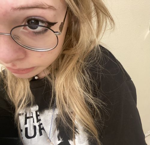 Customer photo review of Linn's Dollie Darknight Black Contact Lenses(12 months of use)