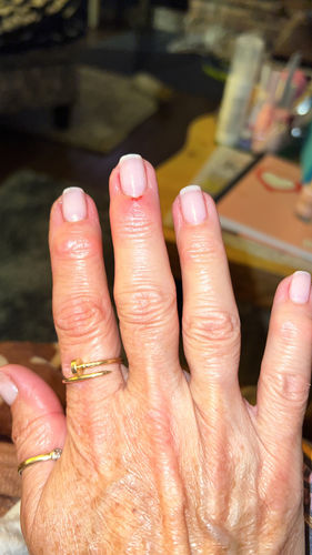 Customer photo review of Smooth Ridge Filler