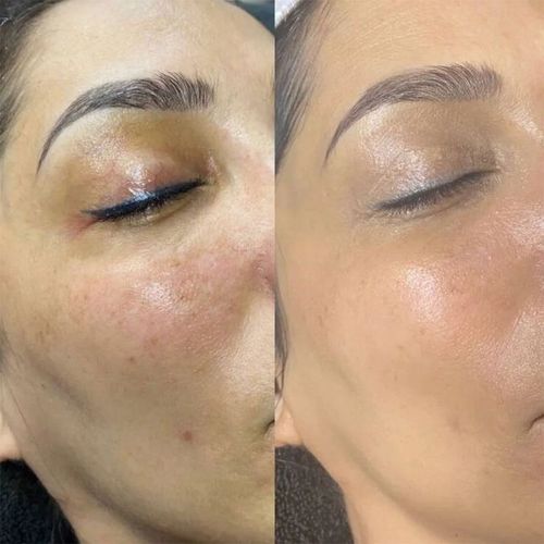 Customer photo review of Crema viso alla Vitamina C Pura