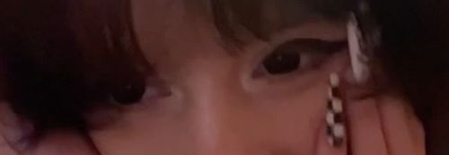 Customer photo review of Linn's Dollie Darknight Black Contact Lenses(12 months of use)