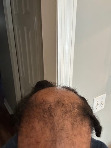 Customer result