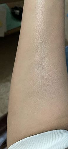 Customer photo review of Super Pack de Depilación Permanente SM