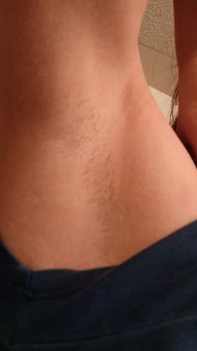 Customer photo review of Depiladora Premium IPL
