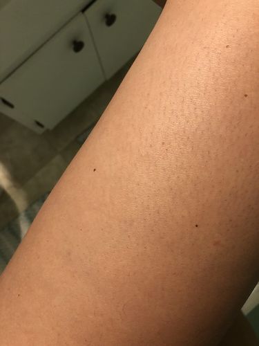 Customer photo review of Depiladora Premium IPL