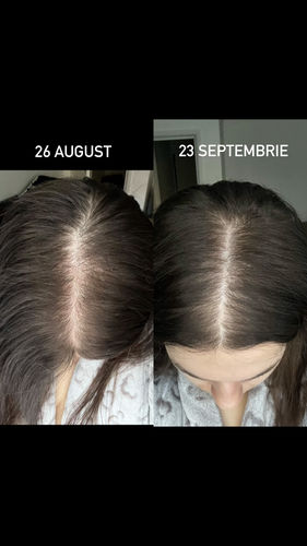 Customer photo review of Growth & Shine Hair Oil