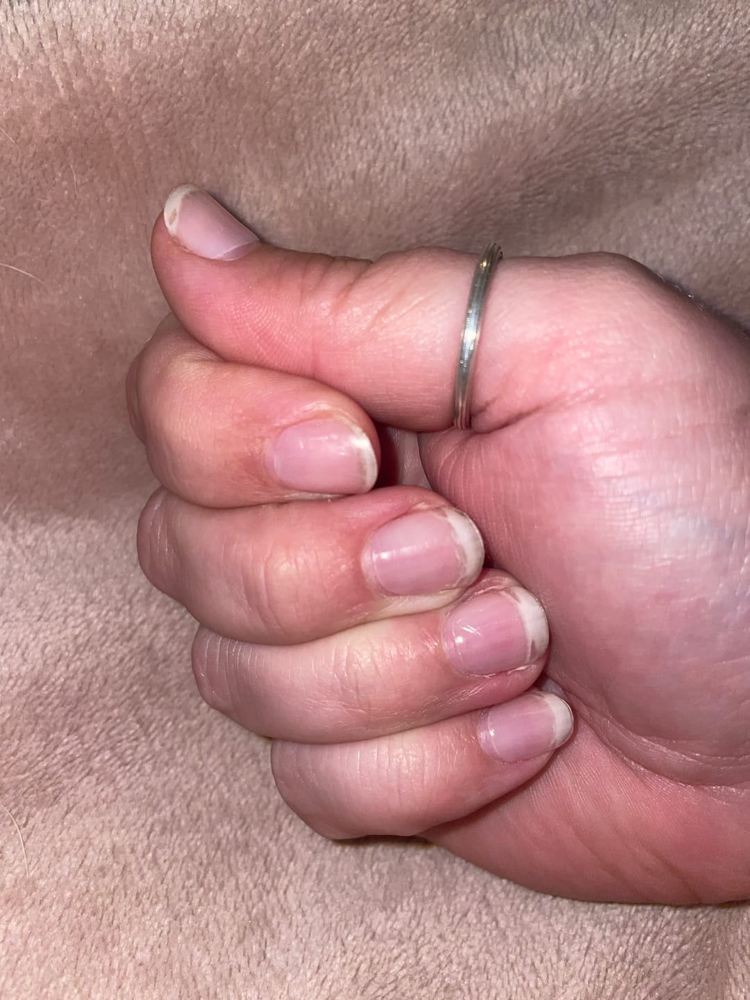 Customer photo review of Crystal Clear DIY Semicured Gel Nail Sticker Kit (STOP NAIL BITING & GROW BRITTLE NAILS)