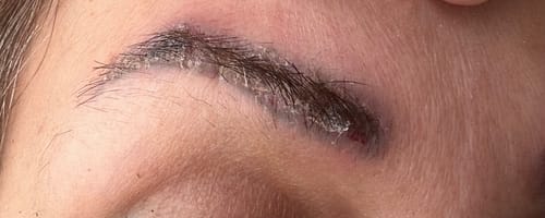 Customer photo review of LI-FT Pigment Lightning & Removal Solution