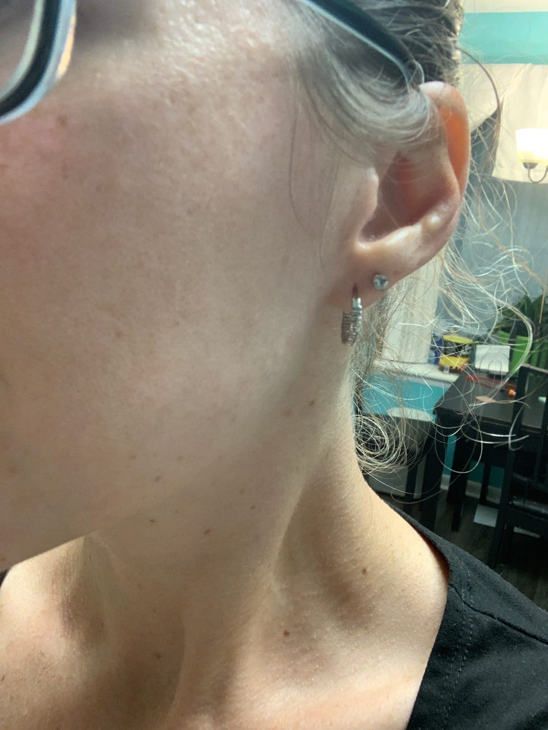Customer photo review of Bolden Dark Spot Fix