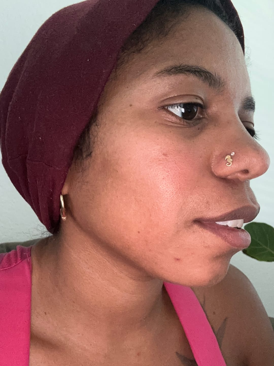 Customer photo review of Bolden Clear Skin Kit
