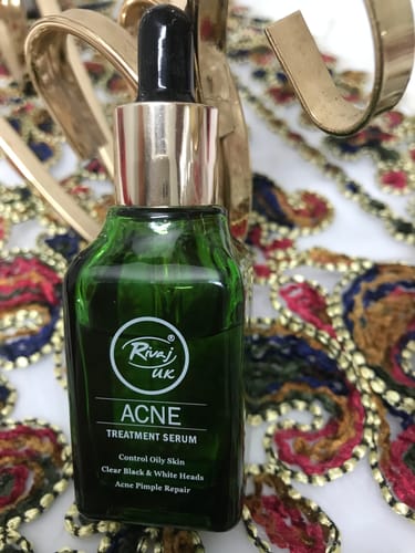 Customer photo review of Face Serum - Acne Treatment (30ml)