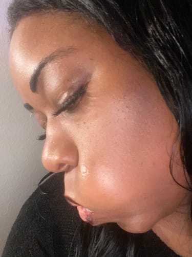 Customer photo review of Organic Dark Spot Corrector