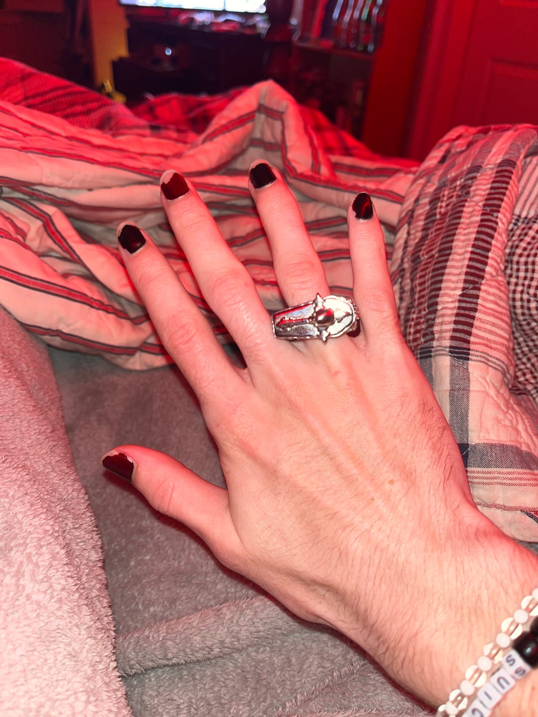 Customer photo review of DYT COFFIN RING