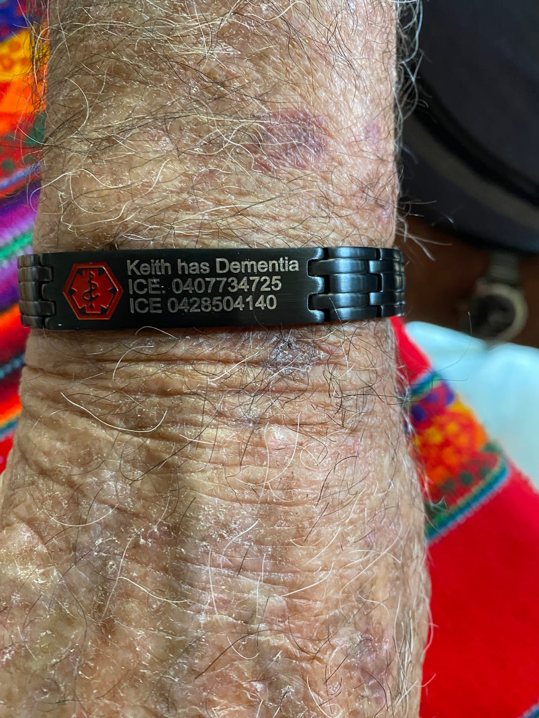 Customer photo review of Black Stainless Steel Medical Alert ID Bracelet for Men