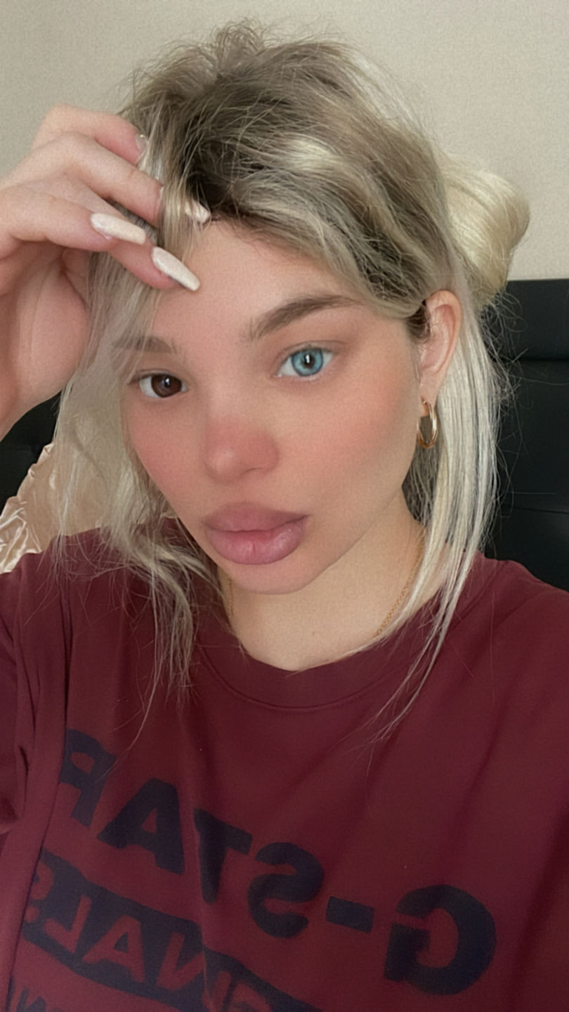 Customer photo review of 2Dadoll King Aqua Blue Contact Lenses(1 pair/6 months)