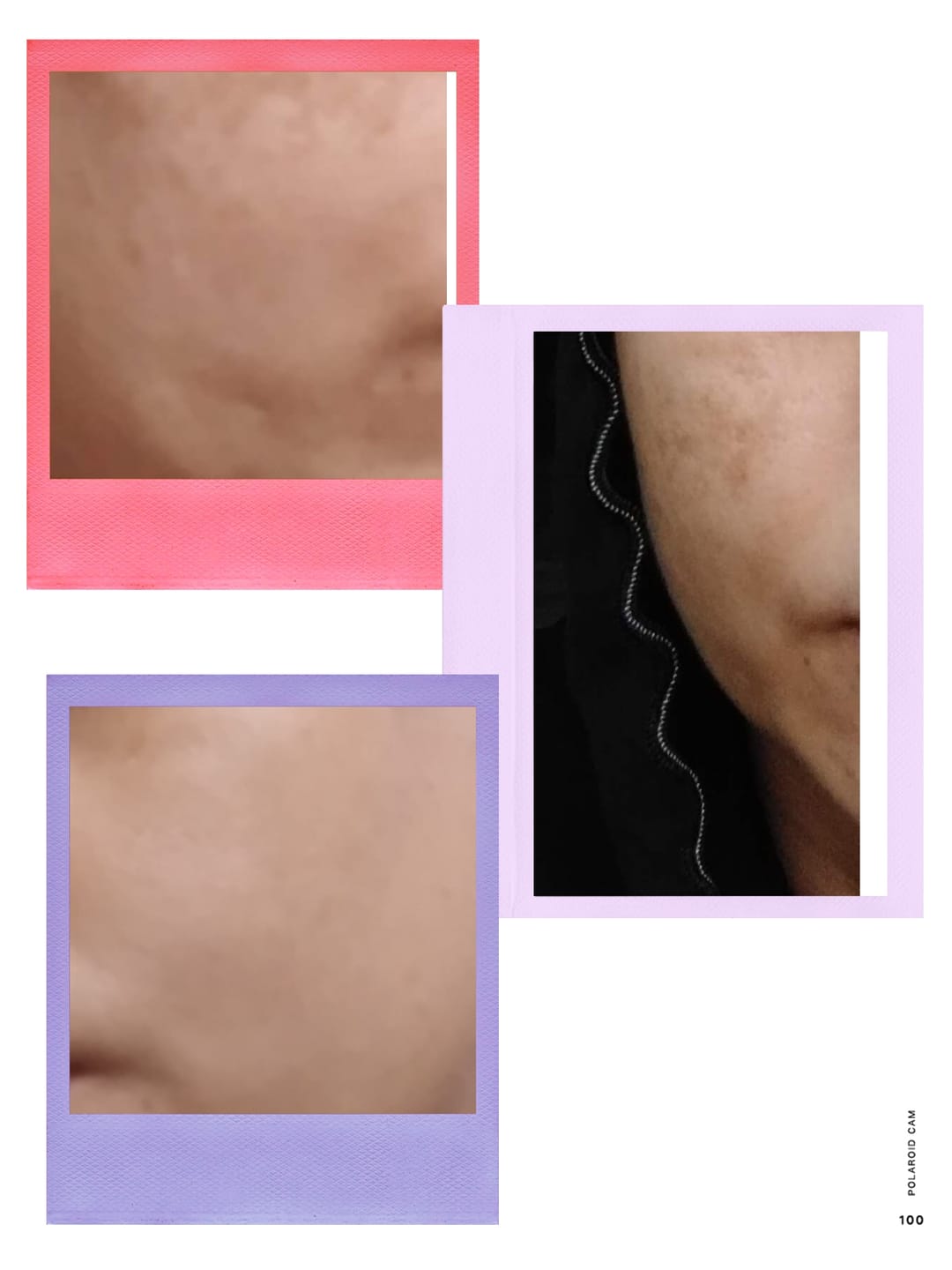 Customer photo review of TRI MELAS SERUM