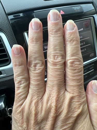Customer photo review of The Nail System