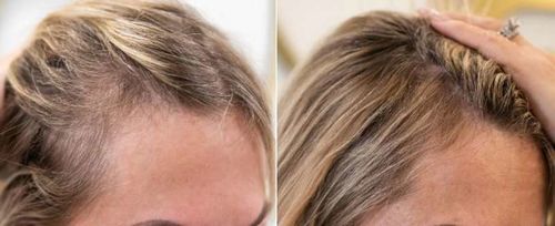 Customer photo review of Ceoerty™ HGrow Rice Water Hair Essence