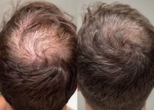 Customer photo review of Ceoerty™ HGrow Rice Water Hair Essence