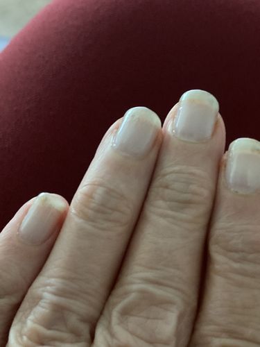 Customer photo review of Rocket Nail Fuel Nail Repair - Clear