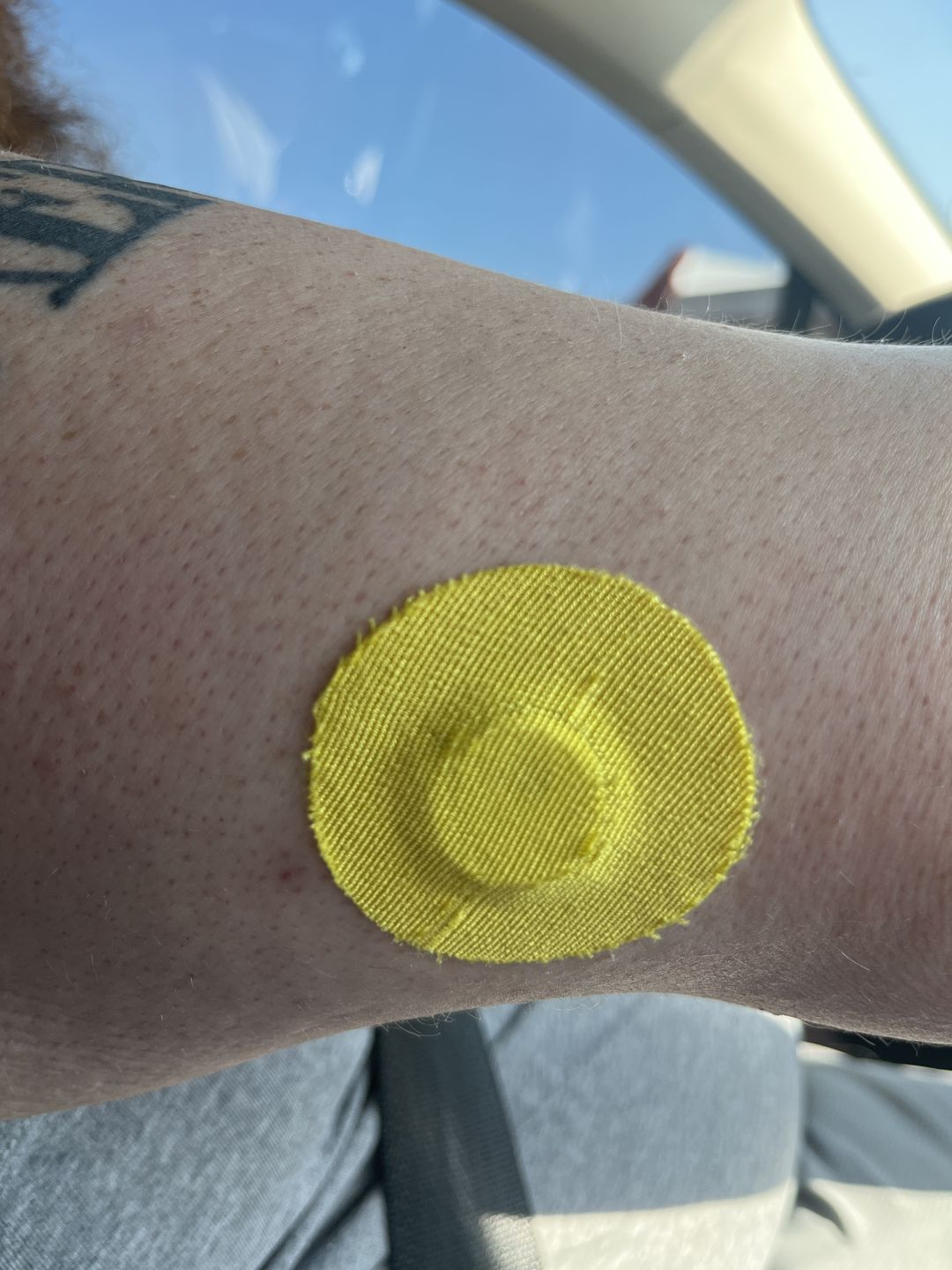 Customer photo review of Skin Grip Original - Freestyle Libre 3 Adhesive Patches