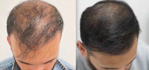 Customer photo review of Ceoerty™ HGrow Rice Water Hair Essence