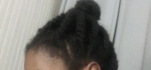 Customer photo review of Hair Recovery Bundle