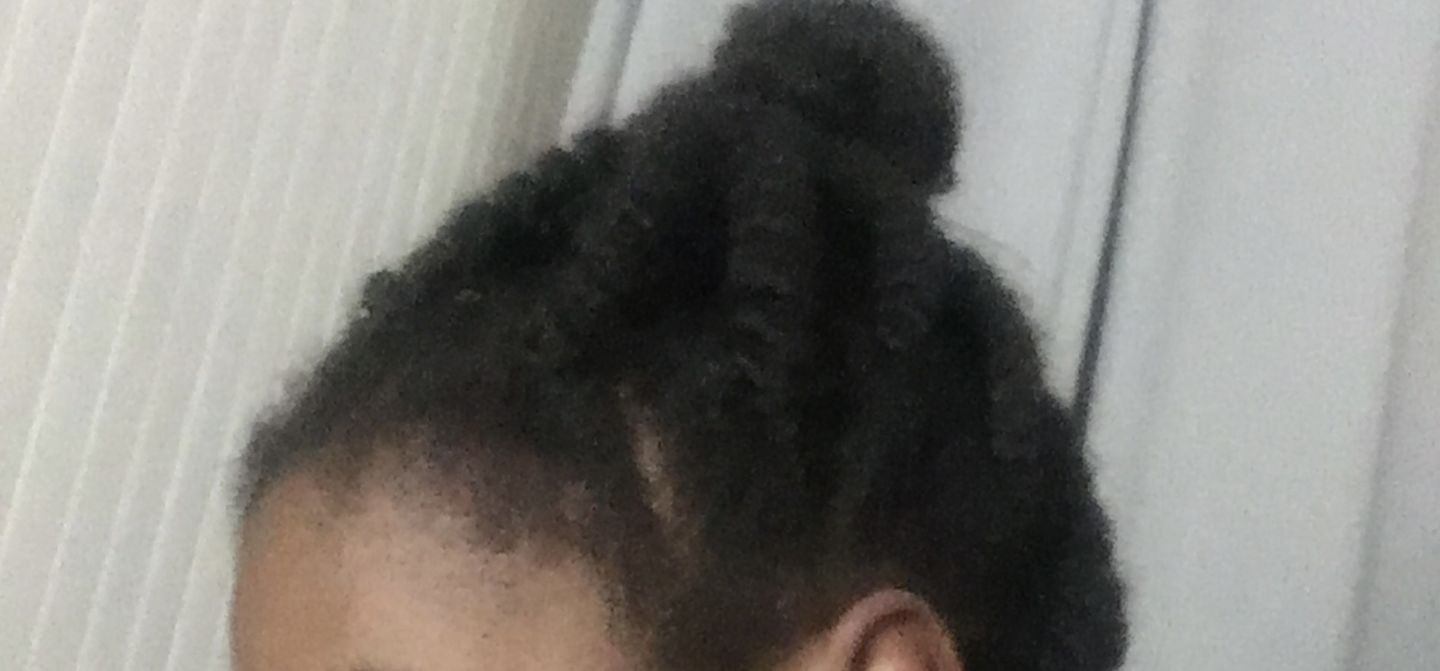 Customer photo review of Hair Recovery Bundle