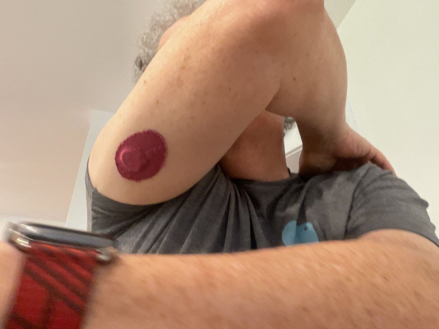 Customer photo review of Skin Grip Original - Freestyle Libre 3 Adhesive Patches