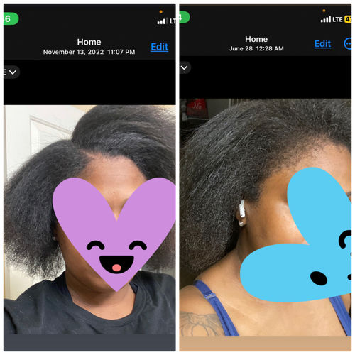 Customer photo review of Rice Oil Scalp Boost