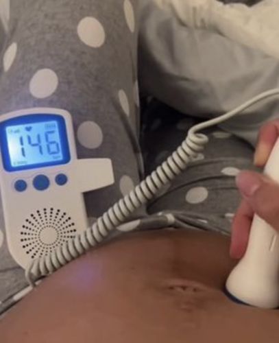 Customer photo review of Home Baby Heartbeat Monitor