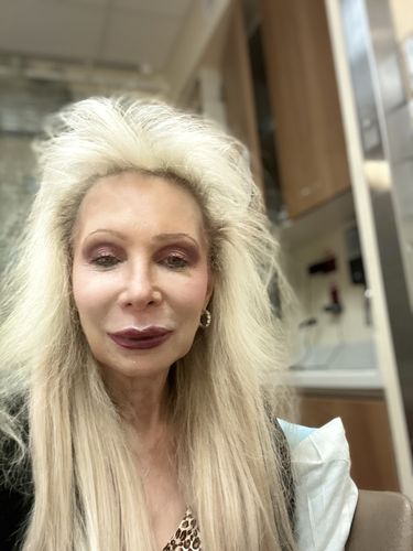 Customer photo review of Permacurl Pro Heated Eyelash Curler