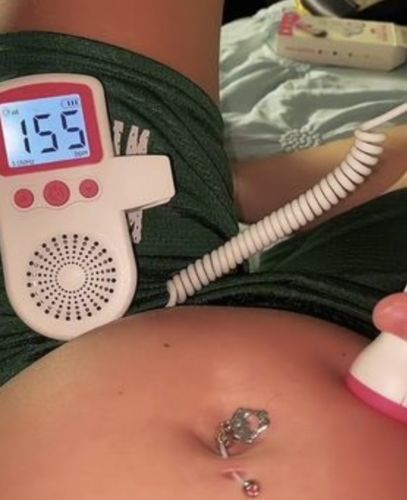 Customer photo review of Home Baby Heartbeat Monitor