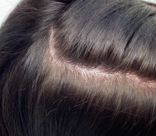 Customer photo review of Day After Brush Clean Dry Shampoo