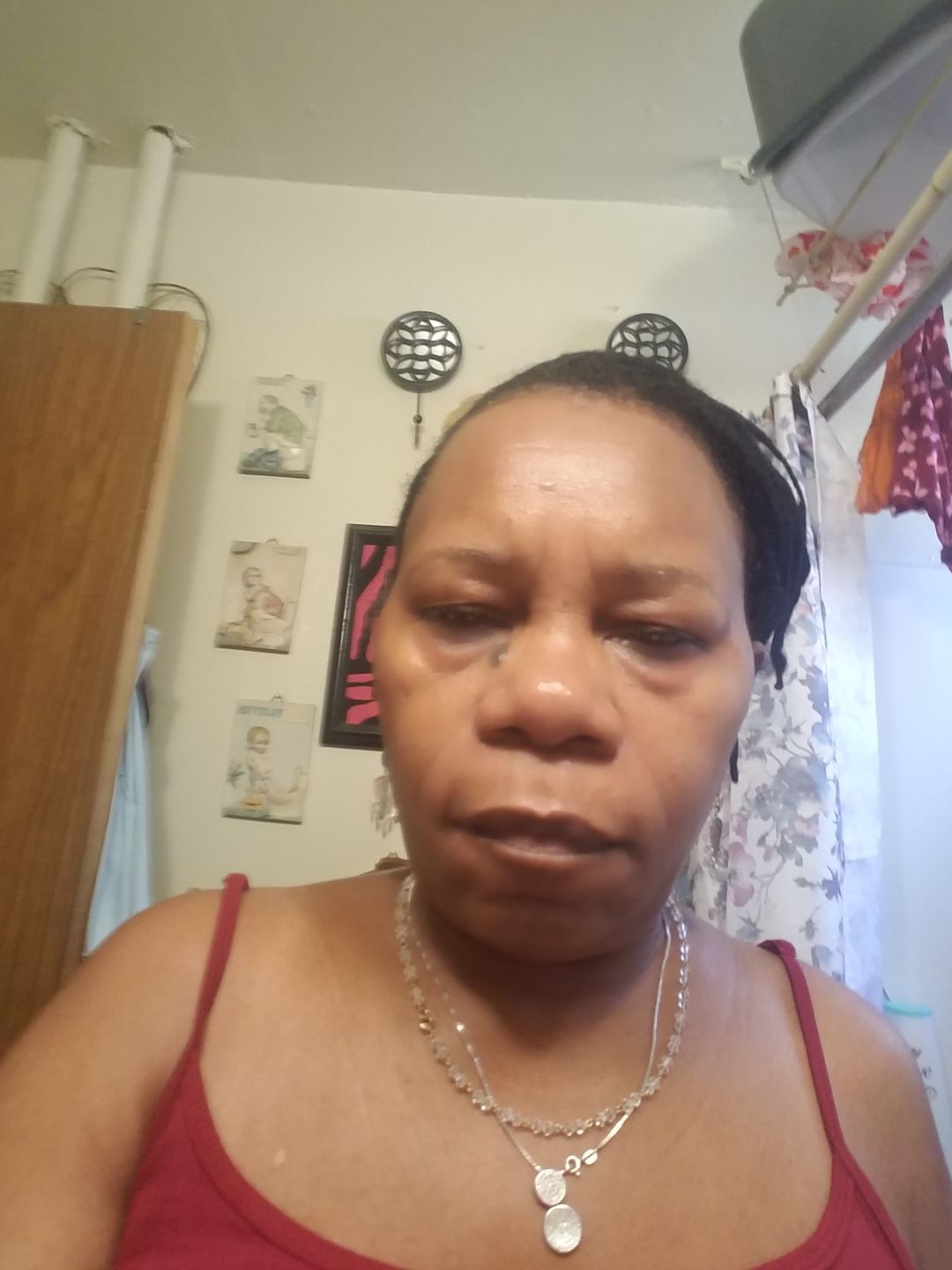 Customer photo review of Awakening Hydrating Serum for Dry Skin