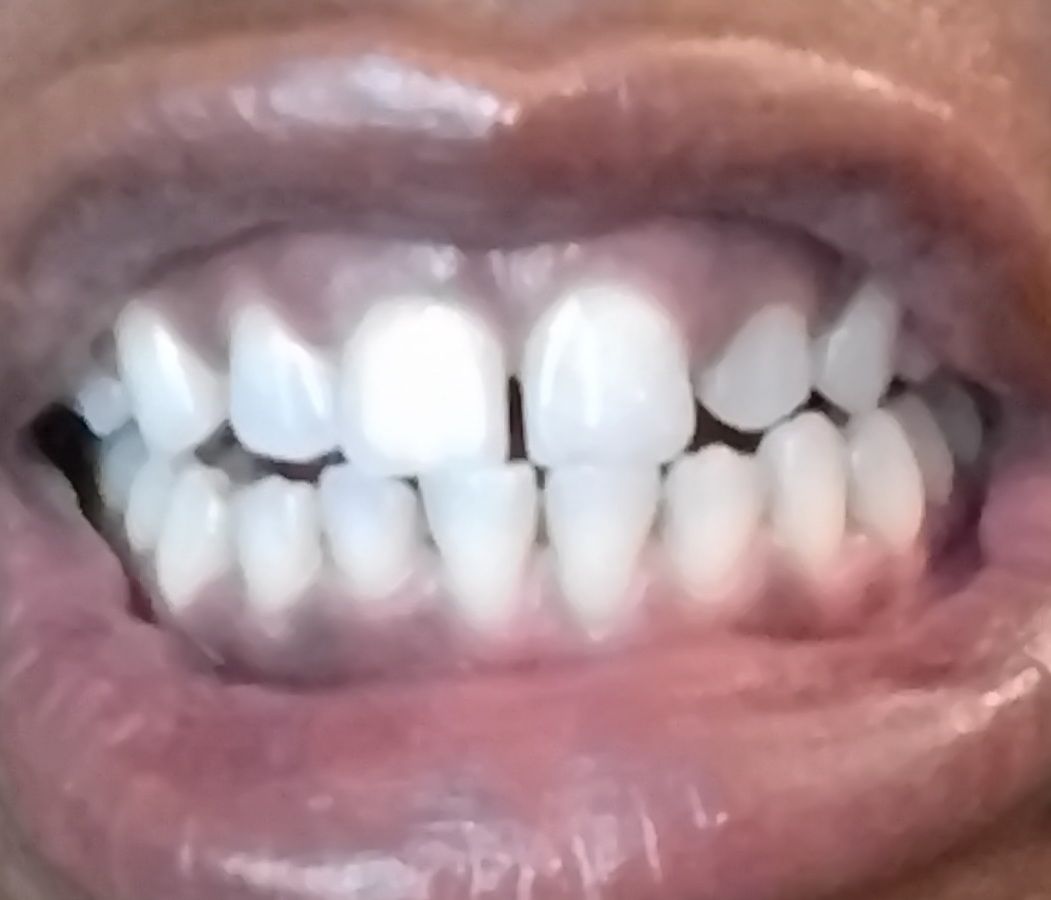 Customer photo review of Jamaican Chew Stick Herbal Tooth Powder
