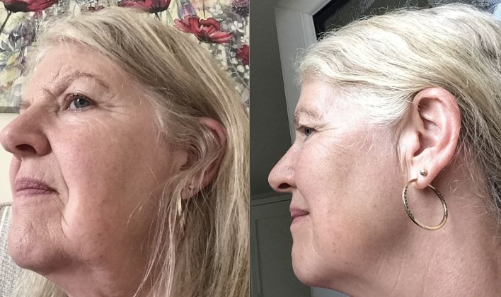 Customer photo review of Daily Collagen Powder