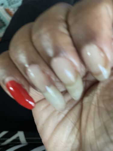 Customer photo review of The Nail Starter Kit